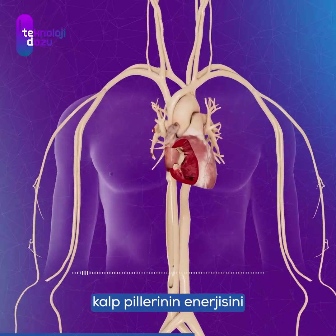 Kablosuz kalp pili: Modern tıbbın büyük başarısı!