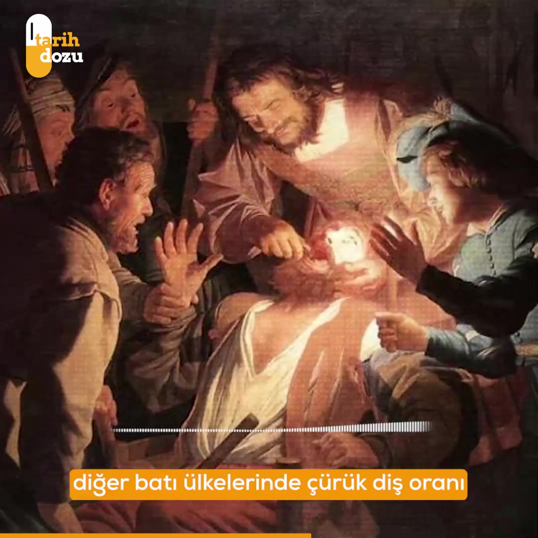 Diş çürümesinin tarihi ve şekerle ilişkisi