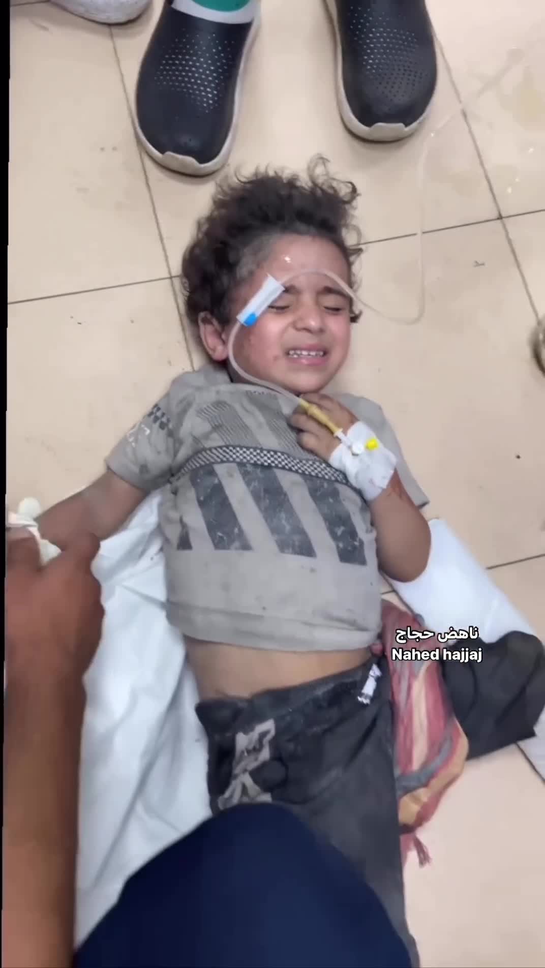 İsrail'in Nuseyrat Kampı'na hava saldırısında 10 çocuk yaralandı