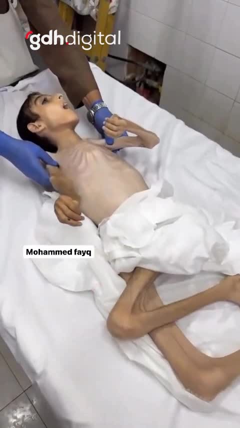 Gazze'de açlıktan ölen sivillerin sayısı 37'ye ulaştı