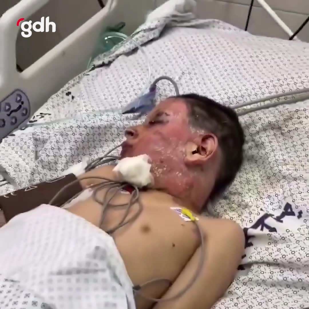 İsrail'in Gazze'deki saldırılarında yaralanan çocuklar ve kayıplar