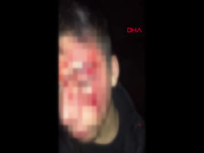 Ereğli'de liseli genç, saldırıya uğrayarak darbedildi