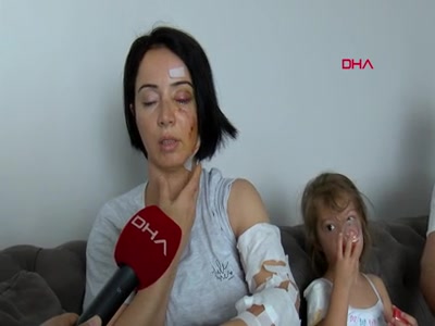 Samsun'da Sibel ve kızı köpek saldırısında yaralandı