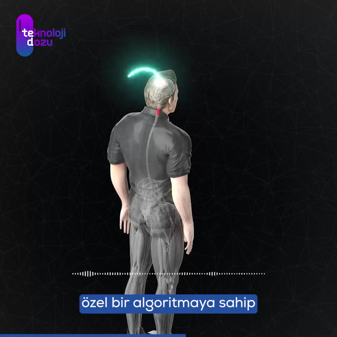 Felçle mücadele için "Digital Bridge" ile yeniden yürümek!