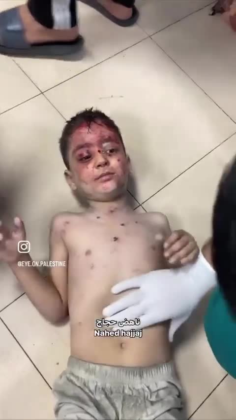 İsrail'in Al-Zawayda'ya düzenlediği saldırıda 10 çocuk yaralandı