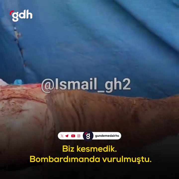 Gazze'de çocuklar, açlıkla başa çıkmak için at kestiler
